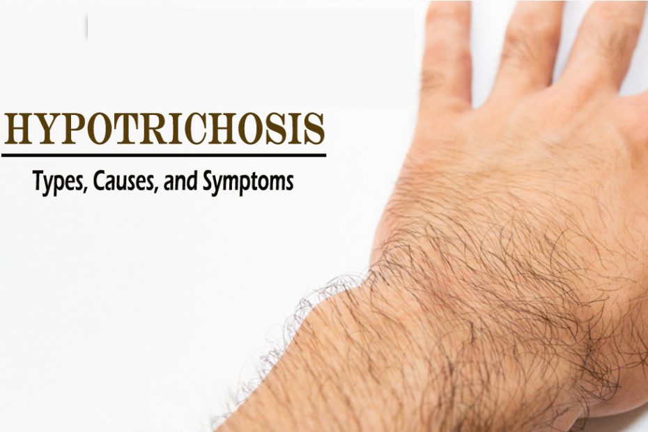 Hypotrichosis- What is Hypotrichosis? Types, Causes, and Symptoms